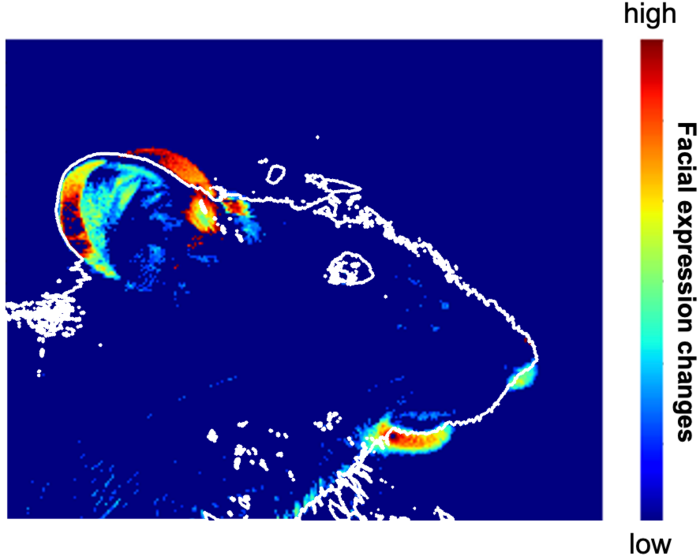 腦干血清素的好壞